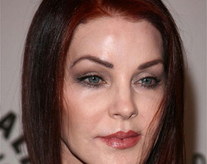 Priscilla Presley desfigurada por una mala cirugía estética